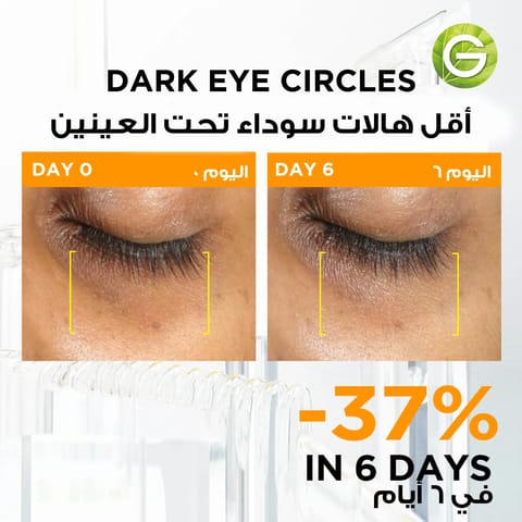 GARNIER 3% Vitamin C & Niacinamide Ampoule 1.5 ml (12 Pcs)